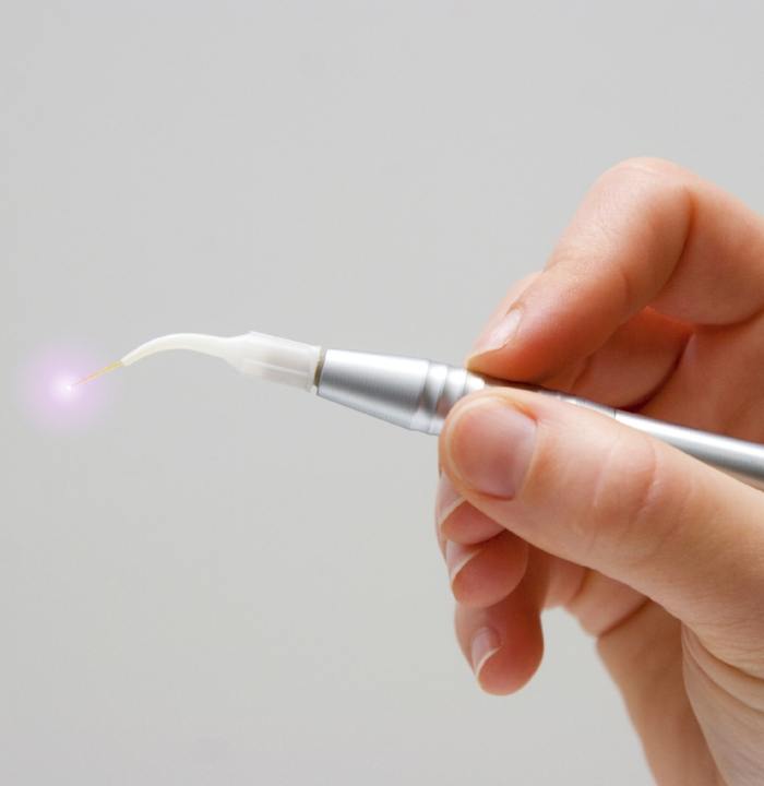 Hand holding a metal dental laser device