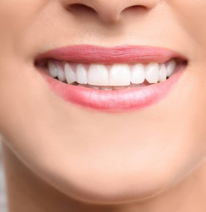 Close up of a person smiling with straight white teeth