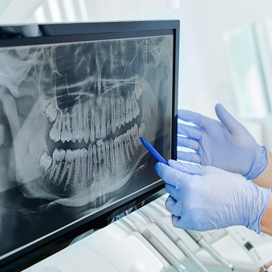 a dentist pointing to an X-ray displayed on a monitor